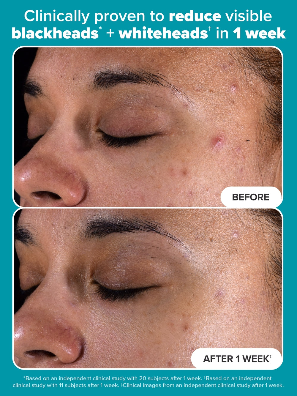Skin Perfecting 2% BHA Liquid Exfoliant