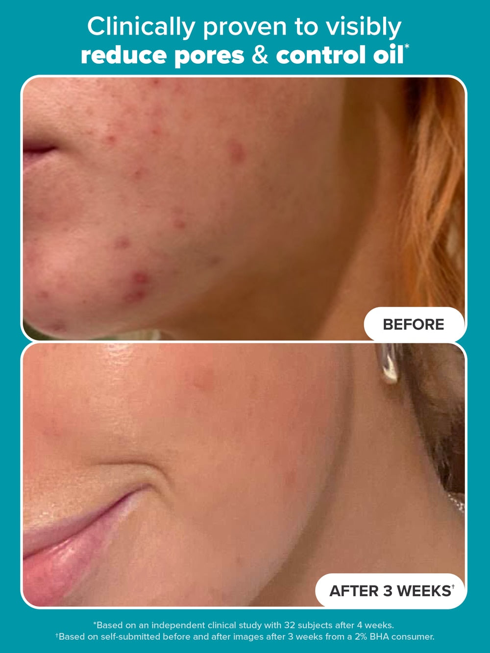 Skin Perfecting 2% BHA Liquid Exfoliant